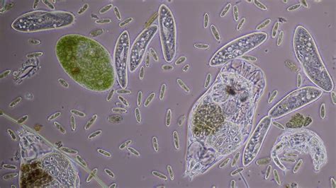  Dissodinium! Una Creatura Microscopiche Che Sfrutta il Movimento Cilíndrico per Navigare nel Mondo Acquatico