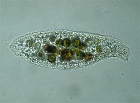  Loxodes: Un Protista Inquietante con un Segno di Domanda sulla sua Natura!