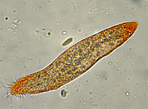  Oxytricha! Un Ciliato che Ci Mostra Come il Mondo Microscopico Può Essere Incredibilmente Complesso e Affascinante